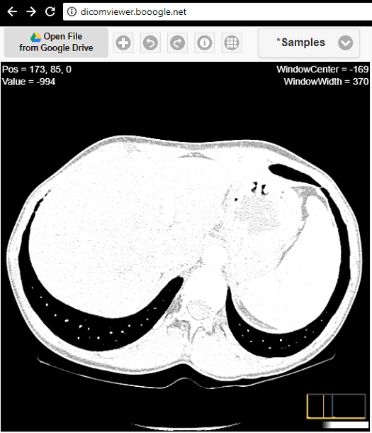 free dicom viewer windows clear