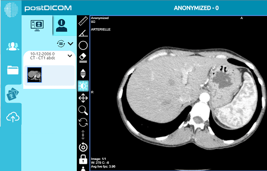 .DCM расширение. Архимед Dicom viewer. Открыть файл DCM.