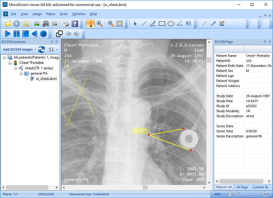 MicroDicom free x-ray viewer