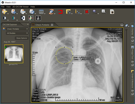 weasis dicom viewer free download