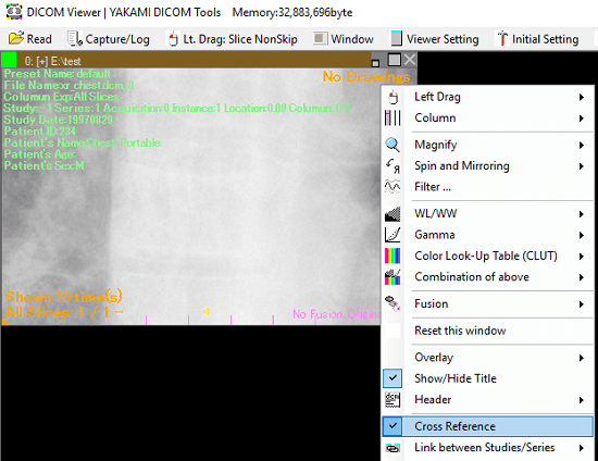 YAKAMI DICOM Viewer