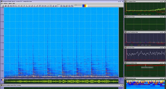 Multiple analyzer view